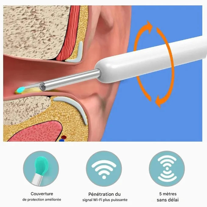 Nettoyeur d’Oreilles avec Caméra HD